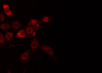 B3GALT1 Antibody - Staining HuvEc cells by IF/ICC. The samples were fixed with PFA and permeabilized in 0.1% Triton X-100, then blocked in 10% serum for 45 min at 25°C. The primary antibody was diluted at 1:200 and incubated with the sample for 1 hour at 37°C. An Alexa Fluor 594 conjugated goat anti-rabbit IgG (H+L) Ab, diluted at 1/600, was used as the secondary antibody.