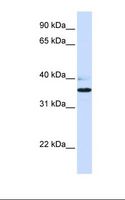 B3GALT1 Antibody - Fetal heart lysate. Antibody concentration: 1.0 ug/ml. Gel concentration: 12%.  This image was taken for the unconjugated form of this product. Other forms have not been tested.