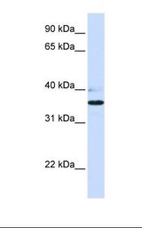 B3GALT1 Antibody - Fetal heart lysate. Antibody concentration: 1.0 ug/ml. Gel concentration: 12%.  This image was taken for the unconjugated form of this product. Other forms have not been tested.