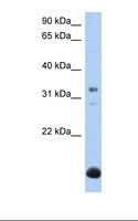 B3GALT6 Antibody - Fetal liver lysate. Antibody concentration: 1.0 ug/ml. Gel concentration: 12%.  This image was taken for the unconjugated form of this product. Other forms have not been tested.
