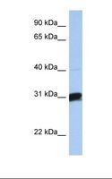 B3GALT6 Antibody - Fetal brain lysate. Antibody concentration: 1.0 ug/ml. Gel concentration: 12%.  This image was taken for the unconjugated form of this product. Other forms have not been tested.