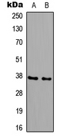 B3GALT6 Antibody - Western blot analysis of B3GALT6 expression in HeLa (A); PC12 (B) whole cell lysates.
