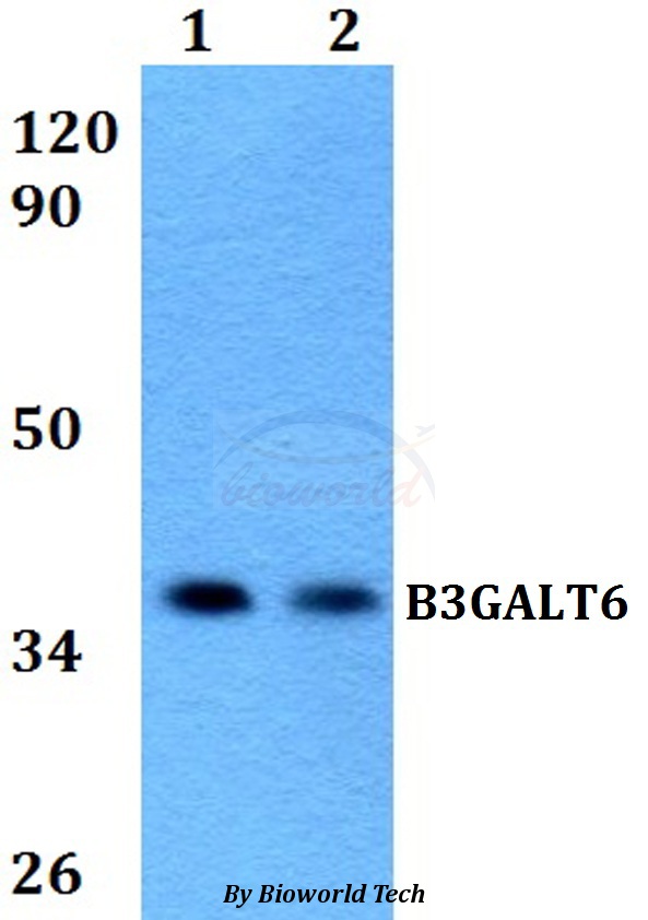 B3GALT6 Antibody - Western blot of B3GALT6 antibody at 1:500 dilution. Lane 1: HeLa whole cell lysate. Lane 2: PC12 whole cell lysate.