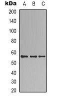 B3GALTL Antibody - Western blot analysis of B3GALTL expression in HEK293T (A); MCF7 (B); HepG2 (C) whole cell lysates.