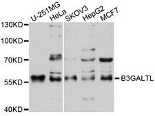 B3GALTL Antibody - Western blot analysis of extracts of various cells.