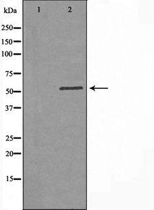 B3GALTL Antibody - Western blot analysis of extracts of HepG2 cells using B3GALTL antibody. The lane on the left is treated with the antigen-specific peptide.