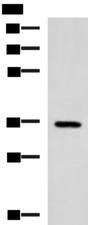 B3GAT1 Antibody - Western blot analysis of Mouse brain tissue lysate  using B3GAT1 Polyclonal Antibody at dilution of 1:650