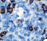 B3GAT1 Antibody - IHC of CD57 on FFPE Tonsil tissue. This image was taken for the unmodified form of this product. Other forms have not been tested.
