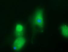 B3GNT2 Antibody - Anti-B3GNT2 mouse monoclonal antibody immunofluorescent staining of COS7 cells transiently transfected by pCMV6-ENTRY B3GNT2.