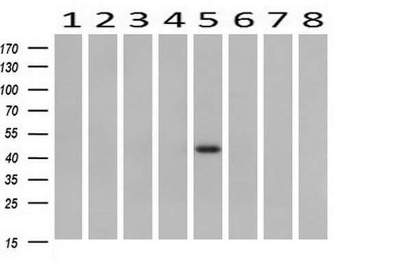 B3GNT2 Antibody - Western blot of extracts (10ug) from 8 Human tissue by using anti-B3GNT2 monoclonal antibody at 1:200 (1: Testis; 2: Uterus; 3: Breast; 4: Brain; 5: Liver; 6: Ovary; 7: Thyroid gland; 8: Colon).