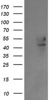 B3GNT2 Antibody - HEK293T cells were transfected with the pCMV6-ENTRY control (Left lane) or pCMV6-ENTRY B3GNT2 (Right lane) cDNA for 48 hrs and lysed. Equivalent amounts of cell lysates (5 ug per lane) were separated by SDS-PAGE and immunoblotted with anti-B3GNT2.