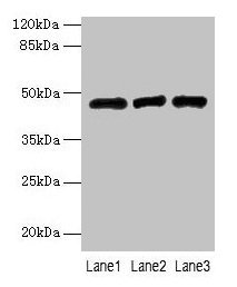 B3GNT2 Antibody - Western blot All lanes: B3GNT2 antibody at 4µg/ml Lane 1: 293T whole cell lysate Lane 2: Jurkat whole cell lysate Lane 3: HL60 whole cell lysate Secondary Goat polyclonal to rabbit IgG at 1/10000 dilution Predicted band size: 47, 46 kDa Observed band size: 47 kDa