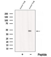 B3GNT3 / TMEM3 Antibody - Western blot analysis of extracts of mouse kidney using B3GNT3 antibody. The lane on the left was treated with blocking peptide.