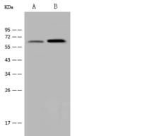 B3GNT3 / TMEM3 Antibody - Anti-B3GNT3 rabbit polyclonal antibody at 1:500 dilution. Lane A: HeLa Whole Cell Lysate. Lane B: Jurkat Whole Cell Lysate. Lysates/proteins at 30 ug per lane. Secondary: Goat Anti-Rabbit IgG (H+L)/HRP at 1/10000 dilution. Developed using the ECL technique. Performed under reducing conditions. Predicted band size: 43 kDa. Observed band size: 60 kDa.