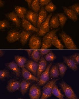 B3GNT4 Antibody - Immunofluorescence analysis of HeLa cells using B3GNT4 Polyclonal Antibody at dilution of 1:100.Blue: DAPI for nuclear staining.