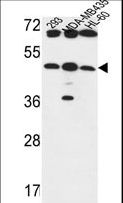 B3GNT5 Antibody - B3GNT5 Antibody western blot of 293,MDA-MB435,HL-60 cell line lysates (35 ug/lane). The B3GNT5 antibody detected the B3GNT5 protein (arrow).
