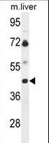 B3GNT5 Antibody - Western blot of B3GNT5 Antibody in mouse liver tissue lysates (35 ug/lane). B3GNT5 (arrow) was detected using the purified antibody.