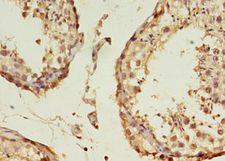 B3GNT5 Antibody - Immunohistochemistry of paraffin-embedded human testis using antibody at 1:100 dilution.  This image was taken for the unconjugated form of this product. Other forms have not been tested.
