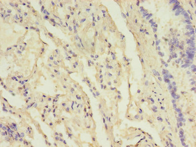 B3GNT5 Antibody - Immunohistochemistry of paraffin-embedded human lung tissue using B3GNT5 Antibody at dilution of 1:100