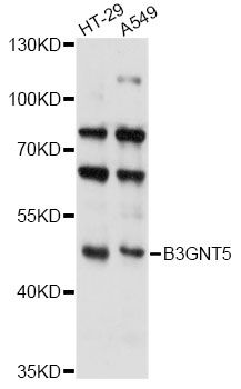 B3GNT5 Antibody - Western blot analysis of extracts of various cell lines, using B3GNT5 antibody at 1:3000 dilution. The secondary antibody used was an HRP Goat Anti-Rabbit IgG (H+L) at 1:10000 dilution. Lysates were loaded 25ug per lane and 3% nonfat dry milk in TBST was used for blocking. An ECL Kit was used for detection and the exposure time was 30s.