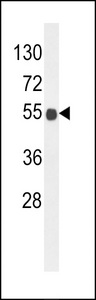 B3GNT6 Antibody - Western blot of B3GNT6 Antibody in mouse brain tissue lysates (35 ug/lane). B3GNT6 (arrow) was detected using the purified antibody.