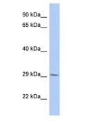 B3GNT6 Antibody - B3GNT6 antibody Western Blot of PANC1. Antibody dilution: 1 ug/ml.  This image was taken for the unconjugated form of this product. Other forms have not been tested.