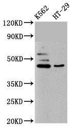 B3GNT6 Antibody - Western Blot Positive WB detected in: K562 whole cell lysate, HT-29 whole cell lysate All Lanes: B3GNT6 antibody at 10µg/ml Secondary Goat polyclonal to rabbit IgG at 1/50000 dilution Predicted band size: 43, 30 KDa Observed band size: 43 KDa
