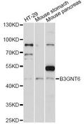 B3GNT6 Antibody - Western blot analysis of extracts of various cell lines, using B3GNT6 antibody at 1:1000 dilution. The secondary antibody used was an HRP Goat Anti-Rabbit IgG (H+L) at 1:10000 dilution. Lysates were loaded 25ug per lane and 3% nonfat dry milk in TBST was used for blocking. An ECL Kit was used for detection and the exposure time was 60s.
