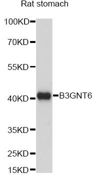 B3GNT6 Antibody - Western blot analysis of extracts of rat stomach, using B3GNT6 antibody at 1:1000 dilution. The secondary antibody used was an HRP Goat Anti-Rabbit IgG (H+L) at 1:10000 dilution. Lysates were loaded 25ug per lane and 3% nonfat dry milk in TBST was used for blocking. An ECL Kit was used for detection and the exposure time was 60s.