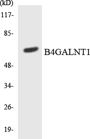 B4GALNT1 / GM2/GD2 Synthase Antibody - Western blot analysis of the lysates from COLO205 cells using B4GALNT1 antibody.