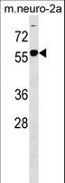 B4GALNT1 / GM2/GD2 Synthase Antibody - B4GALNT1 Antibody western blot of mouse Neuro-2a cell line lysates (35 ug/lane). The B4GALNT1 Antibody detected the B4GALNT1 protein (arrow).