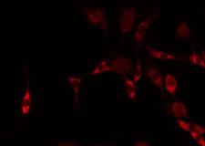 B4GALNT1 / GM2/GD2 Synthase Antibody - Staining HeLa cells by IF/ICC. The samples were fixed with PFA and permeabilized in 0.1% Triton X-100, then blocked in 10% serum for 45 min at 25°C. The primary antibody was diluted at 1:200 and incubated with the sample for 1 hour at 37°C. An Alexa Fluor 594 conjugated goat anti-rabbit IgG (H+L) Ab, diluted at 1/600, was used as the secondary antibody.