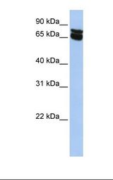 B4GALNT1 / GM2/GD2 Synthase Antibody - HepG2 cell lysate. Antibody concentration: 1.0 ug/ml. Gel concentration: 12%.  This image was taken for the unconjugated form of this product. Other forms have not been tested.