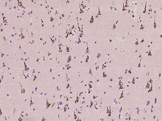 B4GALNT1 / GM2/GD2 Synthase Antibody - Immunochemical staining of human B4GALNT1 in human brain with rabbit polyclonal antibody at 1:100 dilution, formalin-fixed paraffin embedded sections.