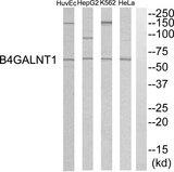 B4GALNT1 / GM2/GD2 Synthase Antibody - Western blot analysis of extracts from HeLa cells, K562 cells, HepG2 cells and HuvEC cells, using B4GALNT1 antibody.