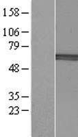 B4GALNT2 Protein - Western validation with an anti-DDK antibody * L: Control HEK293 lysate R: Over-expression lysate