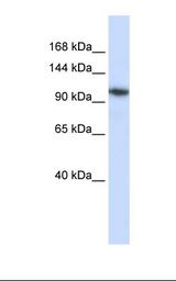 B4GALNT3 Antibody - Hela cell lysate. Antibody concentration: 1.0 ug/ml. Gel concentration: 6-18%.  This image was taken for the unconjugated form of this product. Other forms have not been tested.
