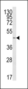B4GALT1 Antibody - Western blot of B4GalT1 Antibody in HL-60 cell line lysates (35 ug/lane). B4GALT1 (arrow) was detected using the purified antibody.