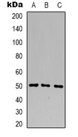 B4GALT1 Antibody - Western blot analysis of B4GALT1 expression in HL60 (A); HEK293T (B); Jurkat (C) whole cell lysates.