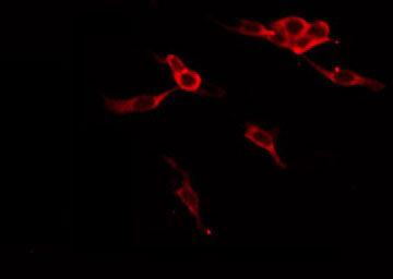 B4GALT1 Antibody - Staining HeLa cells by IF/ICC. The samples were fixed with PFA and permeabilized in 0.1% Triton X-100, then blocked in 10% serum for 45 min at 25°C. The primary antibody was diluted at 1:200 and incubated with the sample for 1 hour at 37°C. An Alexa Fluor 594 conjugated goat anti-rabbit IgG (H+L) Ab, diluted at 1/600, was used as the secondary antibody.