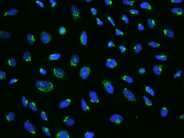 B4GALT1 Antibody - Immunofluorescence staining of B4GALT1 in HeLa cells. Cells were fixed with 4% PFA, permeabilzed with 0.3% Triton X-100 in PBS, blocked with 10% serum, and incubated with rabbit anti-Human B4GALT1 polyclonal antibody (dilution ratio 1:200) at 4°C overnight. Then cells were stained with the Alexa Fluor 488-conjugated Goat Anti-rabbit IgG secondary antibody (green) and counterstained with DAPI (blue). Positive staining was localized to Cytoplasm.
