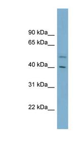 B4GALT2 Antibody - B4GALT2 antibody Western blot of Fetal Thymus lysate. This image was taken for the unconjugated form of this product. Other forms have not been tested.