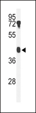 B4GALT2 Antibody - Western blot of B4GALT2 Antibody in mouse testis tissue lysates (35 ug/lane). B4GALT2 (arrow) was detected using the purified antibody.