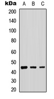 B4GALT2 Antibody - Western blot analysis of B4GALT2 expression in A549 (A); NS-1 (B); PC12 (C) whole cell lysates.