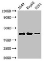 B4GALT2 Antibody - Western Blot Positive WB detected in:A549 whole cell lysate,HepG2 whole cell lysate,U251 whole cell lysate All Lanes:B4GALT2 antibody at 3.5µg/ml Secondary Goat polyclonal to rabbit IgG at 1/50000 dilution Predicted band size: 42,35,45 KDa Observed band size: 42 KDa