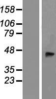 B4GALT2 Protein - Western validation with an anti-DDK antibody * L: Control HEK293 lysate R: Over-expression lysate