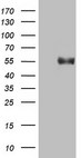 B4GALT3 Antibody - HEK293T cells were transfected with the pCMV6-ENTRY control. (Left lane) or pCMV6-ENTRY B4GALT3. (Right lane) cDNA for 48 hrs and lysed. Equivalent amounts of cell lysates. (5 ug per lane) were separated by SDS-PAGE and immunoblotted with anti-B4GALT3. (1:2000)