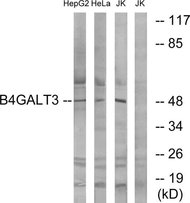 B4GALT3 Antibody - Western blot analysis of lysates from Jurkat, HeLa, and HepG2 cells, using B4GALT3 Antibody. The lane on the right is blocked with the synthesized peptide.