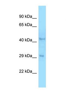 B4GALT3 Antibody - B4GALT3 antibody Western blot of Rat Liver lysate. Antibody concentration 1 ug/ml.  This image was taken for the unconjugated form of this product. Other forms have not been tested.