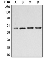B4GALT3 Antibody - Western blot analysis of B4GALT3 expression in Jurkat (A); HL60 (B); HeLa (C); COLO205 (D) whole cell lysates.